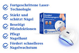 PureNail™ | Pilz-Lasertherapiegerät - Ihre Geheimwaffe gegen Nagelpilz