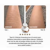 Luminessa Sculpt – Glattere, straffere Haut von zu Hause aus