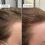 Glow Drops-  Mikronadel Pflege System