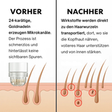 Glow Drops-  Mikronadel Pflege System