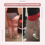 Siluetta Curve - Komfort und Selbstvertrauen in Bewegung